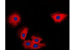 Immunofluorescent analysis of TIMP2 staining in MCF7 cells.