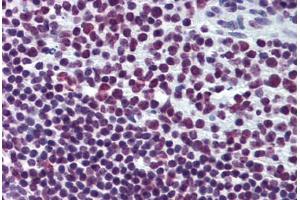 Human Tonsil: Formalin-Fixed, Paraffin-Embedded (FFPE)