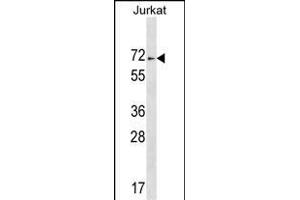 ZN Antibody (C-term) (ABIN1537425 and ABIN2849297) western blot analysis in Jurkat cell line lysates (35 μg/lane). (ZNF613 anticorps  (C-Term))