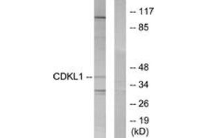 Western blot analysis of extracts from COLO205 cells, using CDKL1 Antibody. (CDKL1 anticorps  (AA 281-330))