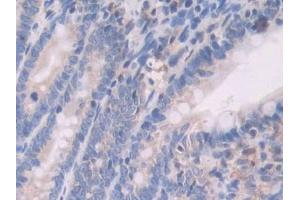 Used in DAB staining on fromalin fixed paraffin- embedded pancreas tissue (UCP1 anticorps  (AA 179-296))