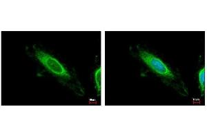 ICC/IF Image TBRG4 antibody detects TBRG4 protein at mitochondria by immunofluorescent analysis.