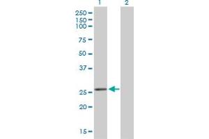 Western Blot analysis of BCAS2 expression in transfected 293T cell line by BCAS2 monoclonal antibody (M01), clone 1D10.