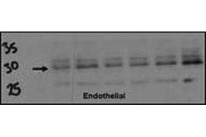 Western blot testing of DSCR1 antibody (1:500) and endothelial cell lysate. (RCAN1 anticorps  (AA 75-104))