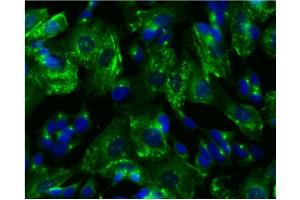 Immunofluorescence (IF) image for anti-Protein Kinase, CAMP-Dependent, Regulatory, Type II, beta (PRKAR2B) (pSer114) antibody (ABIN968875)