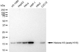 Western blotting analysis using Histone H3 (acetyl K18) antibody (ABIN7798970).
