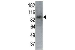 MARK1 antibody used in western blot to detect MARK1 in P7 mouse whole brain lysate (60 ug) at 1:250. (MARK1 anticorps  (AA 6-40))