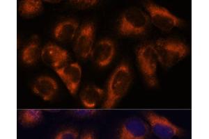 Immunofluorescence analysis of HeLa cells using NDRG4 Polyclonal Antibody at dilution of 1:100. (NDRG4 anticorps)