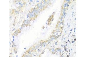 Immunohistochemistry of paraffin-embedded Human lung using EIF3J Polyclonal Antibody at dilution of 1:100 (40x lens). (EIF3S1 anticorps)