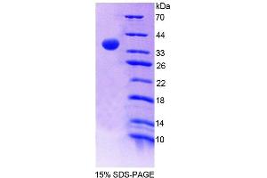 SDS-PAGE (SDS) image for Ribonuclease H2, Subunit A (RNASEH2A) (AA 1-301) protein (His tag) (ABIN4989746) (RNASEH2A Protein (AA 1-301) (His tag))