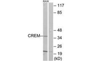 Western blot analysis of extracts from RAW264. (CREM anticorps  (AA 81-130))