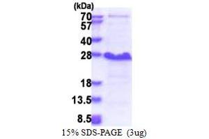 SDS-PAGE (SDS) image for Nedd4 Family Interacting Protein 1 (NDFIP1) (AA 1-116) protein (His tag) (ABIN5853426)