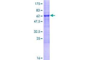 Image no. 1 for Acyl-CoA Binding Domain Containing 4 (ACBD4) (AA 1-305) protein (GST tag) (ABIN1305621)