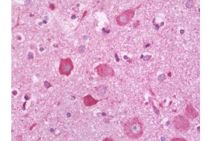 Anti-PLXNC1 / Plexin C1 antibody IHC staining of human brain, cortex. (Plexin C1 anticorps  (AA 1025-1054))