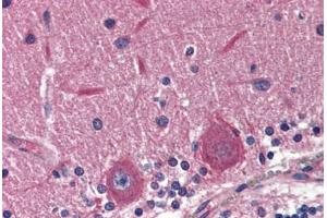 Human Brain, Cerebellum (formalin-fixed, paraffin-embedded) stained with EXOC4 antibody ABIN364381 at 5 ug/ml followed by biotinylated anti-mouse IgG secondary antibody ABIN481714, alkaline phosphatase-streptavidin and chromogen. (Sec8 anticorps)