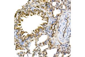 Immunohistochemistry of paraffin-embedded rat lung using ERK1/2 Rabbit mAb (ABIN7268620) at dilution of 1:100 (40x lens).