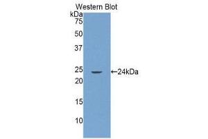 Western Blotting (WB) image for anti-Glutamate Receptor Interacting Protein 1 (GRIP1) (AA 79-268) antibody (ABIN1859070)