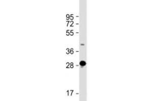 Western blot testing of human skeletal muscle lysate with DNASE1L2 antibody at 1:2000. (DNASE1L2 anticorps  (AA 199-229))