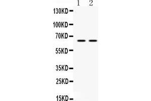 Western blot analysis of HnRNP L expression in PANC whole cell lysates ( Lane 1) and JURKAT whole cell lysates ( Lane 2). (HNRNPL anticorps  (C-Term))