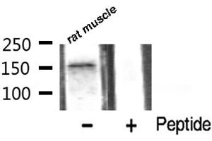 Western blot analysis of VEGFR2 phosphorylation expression in rat muscle tissue lysates,The lane on the right is treated with the antigen-specific peptide. (VEGFR2/CD309 anticorps  (pTyr1059))
