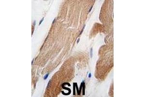 Formalin-fixed and paraffin-embedded human skeletal muscle tissue reacted with ILK Antibody  f antibody, which was peroxidase-conjugated to the secondary antibody, followed by DAB staining. (ILK anticorps  (AA 151-180))