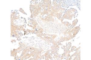 anti-RPTOR Independent Companion of mTOR, Complex 2 (RICTOR) (C-Term) antibody