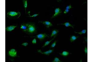 Immunofluorescence staining of U251 cells with ABIN7146356 at 1:110, counter-stained with DAPI.