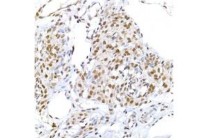 Immunohistochemistry of paraffin-embedded human colon using IL6ST Rabbit pAb (ABIN7268004) at dilution of 1:100 (40x lens).