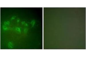 Immunofluorescence analysis of A549 cells, using MDM2 Antibody. (MDM2 anticorps  (AA 391-440))