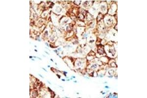 Image no. 2 for anti-Ubiquilin 1 (UBQLN1) (Middle Region) antibody (ABIN357612) (Ubiquilin 1 anticorps  (Middle Region))