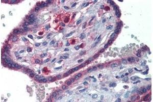 Human Placenta (formalin-fixed, paraffin-embedded) stained with GATA6 antibody ABIN462170 followed by biotinylated goat anti-rabbit IgG secondary antibody ABIN481713, alkaline phosphatase-streptavidin and chromogen.