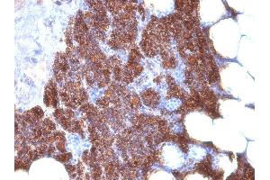 Formalin-fixed, paraffin-embedded human Parathyroid stained with PTH Monoclonal Antibody (3H9 + PTH/1175). (PTH anticorps  (AA 1-34, AA 32-115))