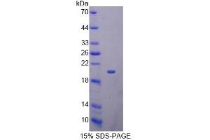 SDS-PAGE analysis of Mouse KLRK1 Protein. (KLRK1 Protéine)