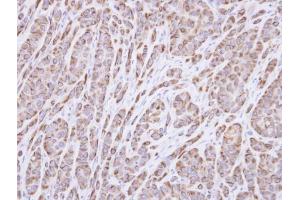 IHC-P Image Immunohistochemical analysis of paraffin-embedded A549 xenograft, using p40 , antibody at 1:100 dilution. (RABEPK anticorps)