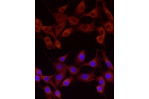 Immunofluorescence analysis of NIH-3T3 using Cortactin antibody (ABIN6127722, ABIN6139243, ABIN6139244 and ABIN6221478) at dilution of 1:25 (40x lens).