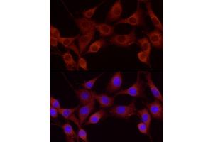 Immunofluorescence analysis of NIH-3T3 using Cortactin antibody (ABIN6127722, ABIN6139243, ABIN6139244 and ABIN6221478) at dilution of 1:25 (40x lens). (Cortactin anticorps  (AA 214-513))