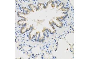 Immunohistochemistry of paraffin-embedded rat lung using TICAM1 antibody.
