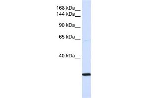 WB Suggested Anti-SMC2 Antibody Titration:  0. (SMC2 anticorps  (N-Term))