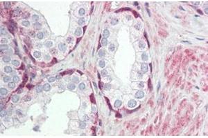 Human Prostate: Formalin-Fixed, Paraffin-Embedded (FFPE) (TRIM59 anticorps  (Internal Region))