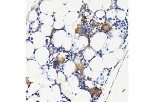 Immunohistochemistry of paraffin-embedded mouse bone marrow using Integrin beta 3 (ITGB3/CD61) Rabbit pAb (ABIN6127572, ABIN6142584, ABIN6142586 and ABIN6219636) at dilution of 1:100 (40x lens). (Integrin beta 3 anticorps  (AA 610-718))
