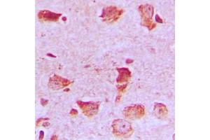 Immunohistochemical analysis of NDUFA8 staining in human brain formalin fixed paraffin embedded tissue section. (NDUFA8 anticorps  (Center))