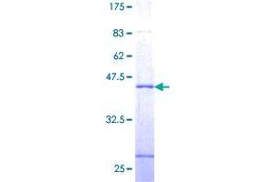 Image no. 1 for Sjogren Syndrome Nuclear Autoantigen 1 (SSNA1) (AA 1-119) protein (GST tag) (ABIN1321412)
