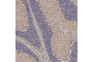 IHC analysis of SFXN5 using anti-SFXN5 antibody (ABIN7601388). (Sideroflexin 5 anticorps  (AA 34-340))