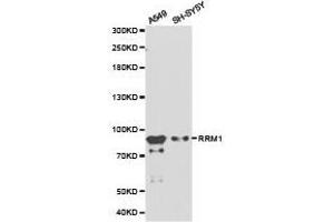 Western Blotting (WB) image for anti-Ribonucleotide Reductase M1 (RRM1) antibody (ABIN1874668) (RRM1 anticorps)