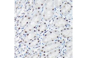 Immunohistochemistry of paraffin-embedded mouse kidney using Phospho-c-Jun-T91 Rabbit pAb (ABIN7268058) at dilution of 1:50 (40x lens). (C-JUN anticorps  (pThr91))