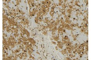 ABIN6274727 at 1/100 staining Mouse muscle tissue by IHC-P.