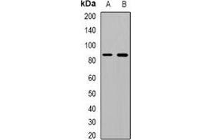 Western blot analysis of Beta Amyloid expression in mouse kidney (A), mouse heart (B) whole cell lysates.