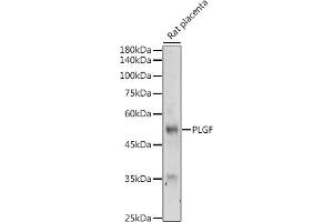 Western blot analysis of extracts of Rat placenta, using PLGF antibody (ABIN7269385) at 1:500 dilution. (PLGF anticorps)