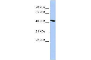 Human PANC1; WB Suggested Anti-ZNF71 Antibody Titration: 1 ug/ml. (ZNF71 anticorps)