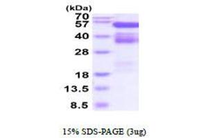 SDS-PAGE (SDS) image for EPH Receptor B4 (EPHB4) (AA 16-539) protein (His tag) (ABIN6387866)